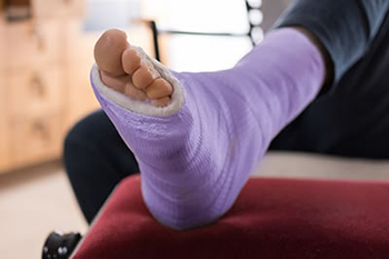 Foot and Ankle fractures treatment in the Cobb County, GA: Atlanta (Sandy Springs, Vinings, Smyrna, Powers Park, East Cobb, Chattahoochee Plantation, Fair Oaks, Mableton, Brookhaven, Dunwoody, Buckhead, Chamblee) and Cherokee County, GA: Woodstock (Oak Grove, Sixes, Holly Springs, Hickory Flat, Willow Tree, Tomahawk, Mountain Park, Canton, Vandiver Heights, Willow Creek, Noonday, Marietta) areas