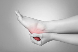 Retrocalcaneal Bursitis