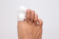 Blunt Force Can Cause a Broken Toe