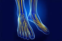 Peroneal Nerve Damage That Affects the Feet